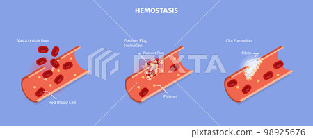 3D Isometric Flat Vector Conceptual Illustration of Hemostasis 98925676