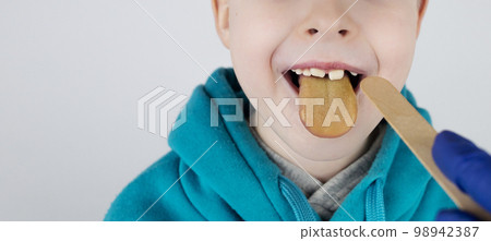Blond boy has a yellow tongue. Painful yellow coating on the mucous membrane of the tongue. Diseases of the gastrointestinal tract, liver and gallbladder. The consequences of taking antibiotics. Blond boy has a yellow tongue. Painful yellow coating on the mucous membrane of the tongue. Diseases of the gastrointestinal tract, liver and gallbladder. The consequences of taking antibiotics. 98942387