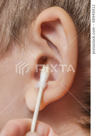 Cleaning the ear with a cotton swab. The process of cleaning the ears close-up, yellow cotton swab with dirt from the ear. Mother cleaning baby's ear, with copy space Cleaning the ear with a cotton swab. The process of cleaning the ears close-up, yellow cotton swab with dirt from the ear. Mother cleaning baby's ear, with copy space 98948912