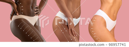 Millennial different women in bikini with slim body with lines for figure shaping or drainage massage and beauty therapy 98957741