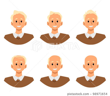 Alopecia stages and hair loss process, flat vector illustration isolated on white background. Alopecia stages and hair loss process, flat vector illustration isolated on white background. 98971654