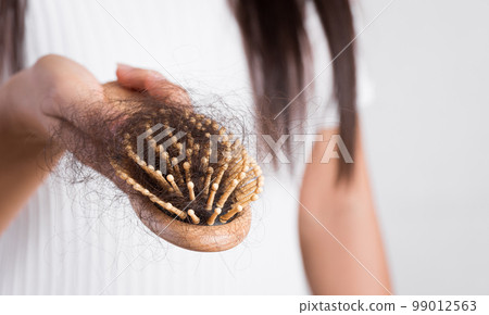 Woman hand holding a comb with hair loss on white background. Health care and medical, Hair loss problem concept. Woman hand holding a comb with hair loss on white background. Health care and medical, Hair loss problem concept. 99012563