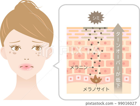皮膚瑕疵周轉和女性橫截面和細胞 99016027