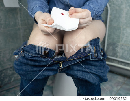 Hemorrhoid concept. Woman sits on the toilet and holds white toilet paper in his hands. There is a little drop of blood on it. Aesthetic presentation of problems with the rectum or hypomenorrhea 99019582