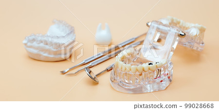 Orthodontic dental theme on yellow background.Transparent invisible dental aligners or braces aplicable for an orthodontic dental treatment 99028668