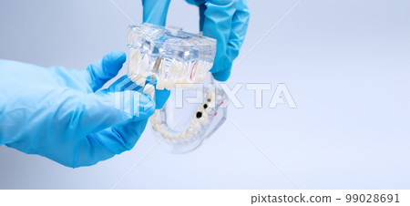 In hand dentists dental teeth teaching model showing each tooth, gum, root, implant, decay, plaque and enamel. In hand dentists dental teeth teaching model showing each tooth, gum, root, implant, decay, plaque and enamel. 99028691