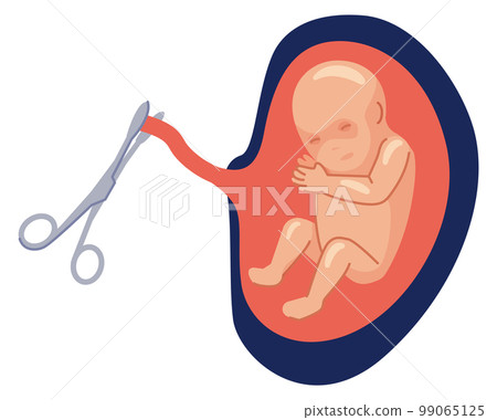 Cutting umblical cord. Baby birth cartoon icon 99065125