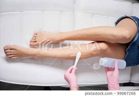 Beautician's hands applying special gel for epilation on client's feets. Top view of preparation process for laser hair removal on slender female legs. Beautician's hands applying special gel for epilation on client's feets. Top view of preparation process for laser hair removal on slender female legs. 99067266