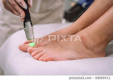 Close up shot of gloved hand with the laser hair removal machine's handpiece along woman leg. Alexandrite laser techhnology removing hair. Beauty procedure Close up shot of gloved hand with the laser hair removal machine's handpiece along woman leg. Alexandrite laser techhnology removing hair. Beauty procedure 99068411
