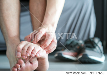 Men wear canvas shoes, he scratches legs and feet with itchy skin. Caused by of shoes Men wear canvas shoes, he scratches legs and feet with itchy skin. Caused by of shoes 99077650