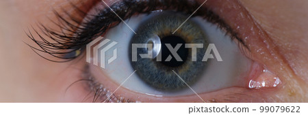 Wide open female eye with gray green pupil and a permanent arrow on eyelid 99079622