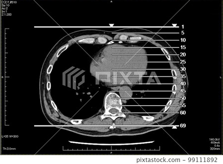 CT scan_03 CT scan_03 99111892