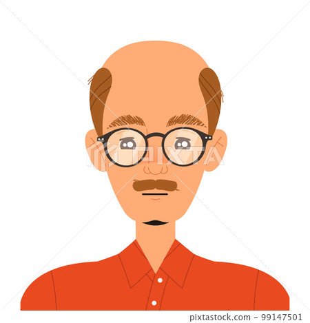 Man Losing His Hair Suffer from Alopecia or Baldness Vector Illustration 99147501
