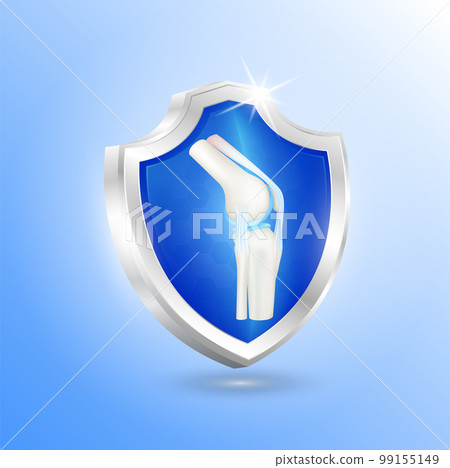 Healthy bone inside shield aluminum transparent. Radius ring surrounds. Help heal arthritis knee joint. 3D realistic vector. For nutrition products design. 99155149