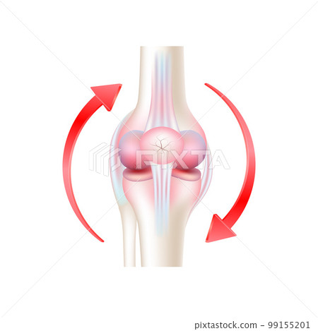 Arthritis bone and circular red arrow around isolated on white background. Products template design. Medical concepts. 3D Realistic Vector EPS10. Arthritis bone and circular red arrow around isolated on white background. Products template design. Medical concepts. 3D Realistic Vector EPS10. 99155201