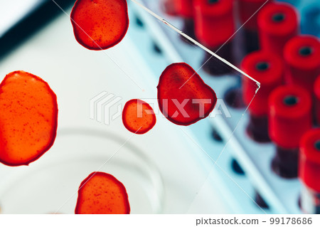 Medical equipment for blood test close up 99178686