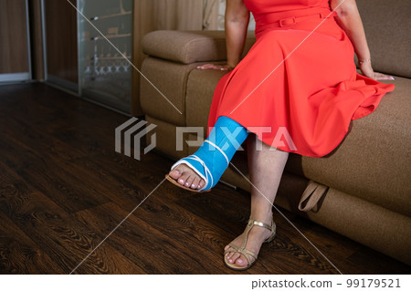 Modern plastic plaster. A woman sits on a couch with a plastic blue cast wrapped around her leg. Modern plastic plaster. A woman sits on a couch with a plastic blue cast wrapped around her leg. 99179521