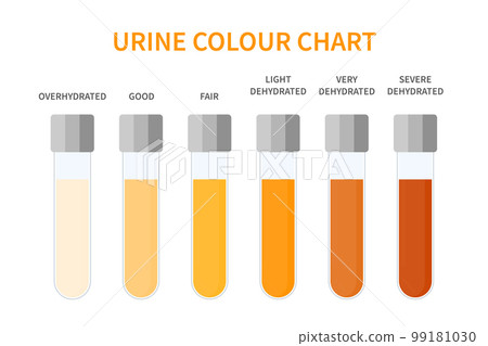 Urine color chart illustration of dehydration level Urine color chart illustration of dehydration level 99181030