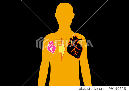heart disease heart disease 99190528