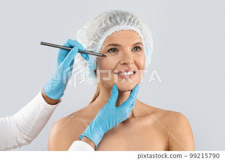 Plastic surgeon hands drawing contours around female eye before surgery 99215790