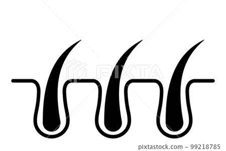 Pore cross section before hair removal, image illustration of hair removal and self-treatment Pore cross section before hair removal, image illustration of hair removal and self-treatment 99218785