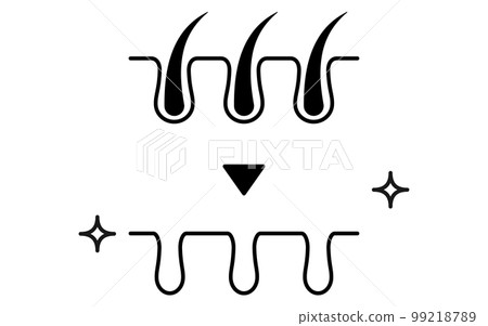 Pore cross section of hair removal, image illustration of hair removal clinic / hair removal salon 99218789