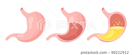 Healthy and unhealthy, empty and full human stomach in flat style, icons set. Nutrition, stomach pain, bloating. Anatomy of the digestive system. Vector 99222912