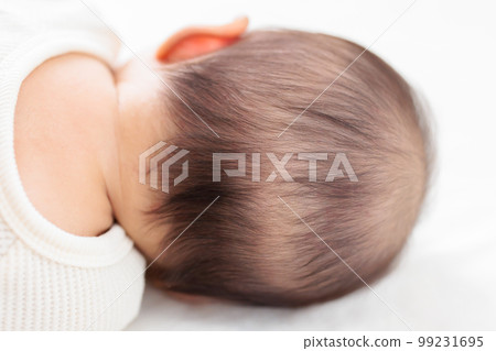 A baby whose back of the head is thinning A baby whose back of the head is thinning 99231695