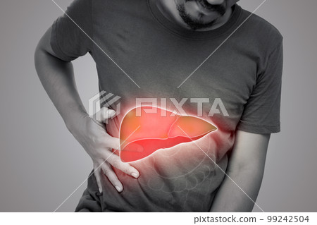 A men with hepatitis and fatty liver problem. 99242504