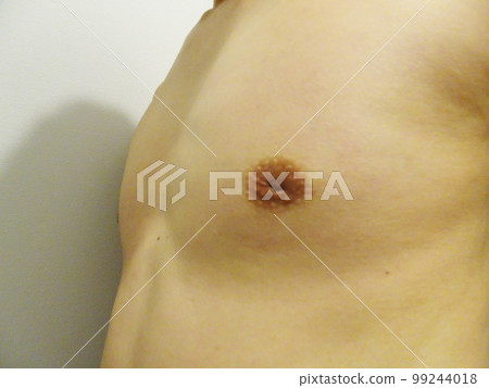 男性乳頭內陷 99244018