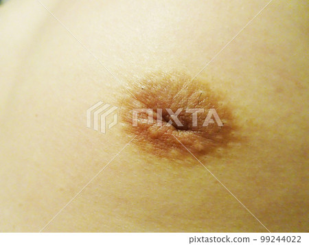 male inverted nipples 99244022