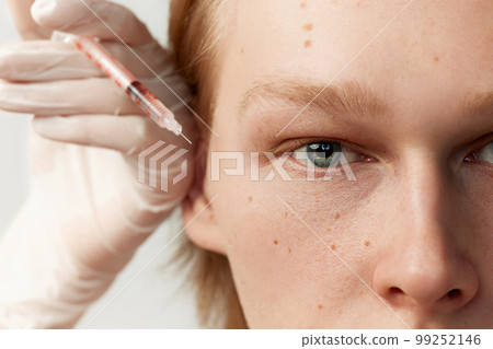 Eye lifting. Young redhead man having cosmetological injections. Male model posing against grey background Eye lifting. Young redhead man having cosmetological injections. Male model posing against grey background 99252146