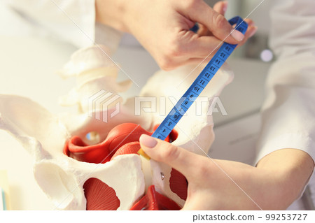 The doctor measures the model of the hip joint, close -up The doctor measures the model of the hip joint, close -up 99253727