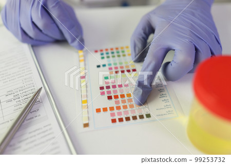 On the table strips of dough pH urine, close-up 99253732