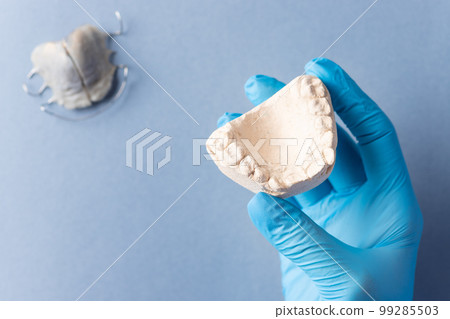 dentist's hand in blue glove holding plaster cast of children's jaw over blue background 99285503