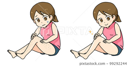 為擔心腿上多餘毛髮的女性脫毛前後 為擔心腿上多餘毛髮的女性脫毛前後 99292244