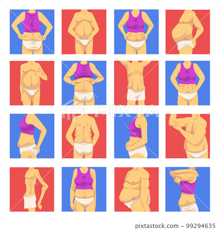 Male and Female Torso with Sagging Belly and Soft Muscles Big Vector Set 99294635
