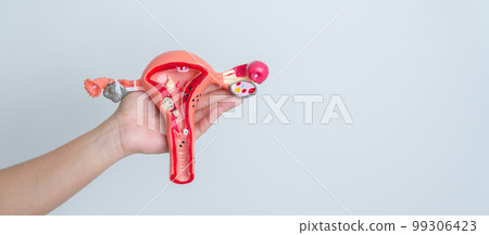 Woman holding Uterus and Ovaries model. Ovarian and Cervical cancer, Cervix disorder, Endometriosis, Hysterectomy, Uterine fibroids, Reproductive system and Pregnancy concept Woman holding Uterus and Ovaries model. Ovarian and Cervical cancer, Cervix disorder, Endometriosis, Hysterectomy, Uterine fibroids, Reproductive system and Pregnancy concept 99306423