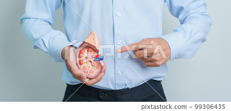 Man holding Anatomical human kidney Adrenal gland model. disease of Urinary system and Stones, Cancer, world kidney day, Chronic kidney and Organ Donor Day concept Man holding Anatomical human kidney Adrenal gland model. disease of Urinary system and Stones, Cancer, world kidney day, Chronic kidney and Organ Donor Day concept 99306435
