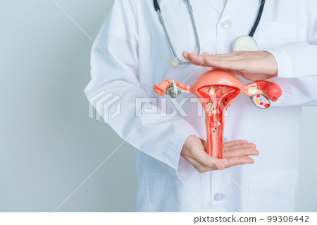 Doctor holding Uterus and Ovaries model. Ovarian and Cervical cancer, Cervix disorder, Endometriosis, Hysterectomy, Uterine fibroids, Reproductive system and Pregnancy concept 99306442
