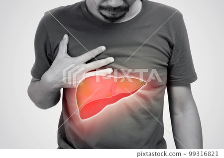 Hepatitis 99316821