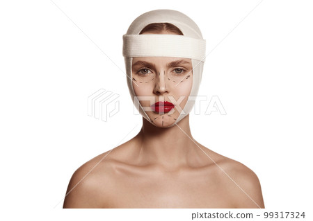 Female face bandaged with medical bandages human emotions. Making beauty, modifying face to make surgical correction, plastic surgery. correction of asymmetry. 99317324