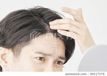 頭髮稀疏的男人的特寫鏡頭 99317579