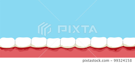 Gum disease cartoon banner. Periodontitis, gum bleeding, plaque on the teeth. Flat vector isolated illustration 99324158