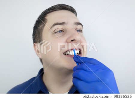 Interdental brush. A man shows a brush for cleaning the interdental space. Brush for cleaning teeth and daily oral care. Dentistry and orthodontics  99326526