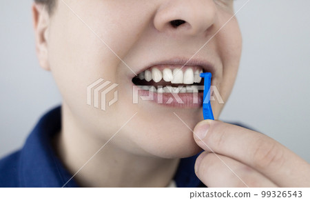 Interdental brush. A man shows a brush for cleaning the interdental space. Brush for cleaning teeth and daily oral care. Dentistry and orthodontics Interdental brush. A man shows a brush for cleaning the interdental space. Brush for cleaning teeth and daily oral care. Dentistry and orthodontics 99326543