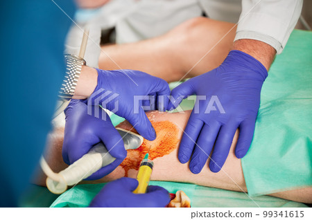 Close up of doctors making injection in knee and ultrasound diagnostics in hospital. Men wearing robe and latex gloves, patient lying on couchette. Concept of medicine and taking care of health. Close up of doctors making injection in knee and ultrasound diagnostics in hospital. Men wearing robe and latex gloves, patient lying on couchette. Concept of medicine and taking care of health. 99341615