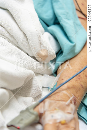 Patient in the hospital with pulse gauge on finger Patient in the hospital with pulse gauge on finger 99344395
