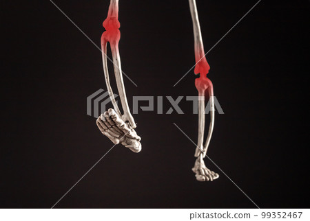Human skeleton legs with painful knees with red point on black background. Frontal view. Sprain, strain, fracture, kneecap dislocation. Health disorders, anatomy concept. 99352467
