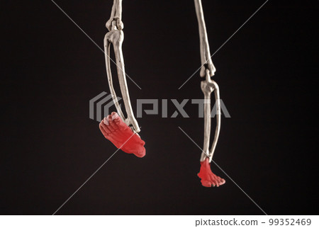 Human skeleton legs with painful feet with red point on black background. Frontal view. Injury, overuse, bones inflammation. Medical conditions, anatomy concept. 99352469